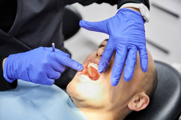 Best Emergency Wisdom Tooth Extraction in Courtland, VA